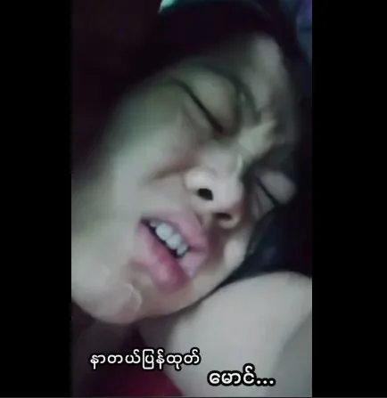 နာတယ် ပြန်ထုတ်မောင်