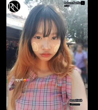 အငုံးလေးဘယ်လိုတောင်လား ပါးကွက်ကြားလေးနဲ့